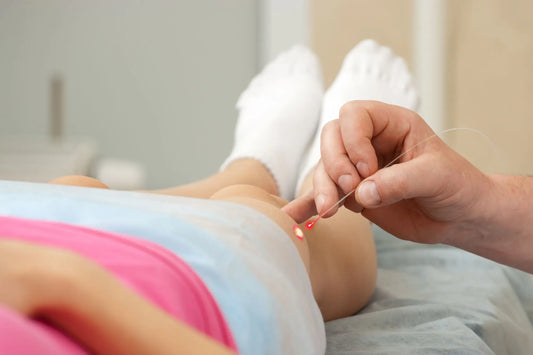 Varicose veins: everything you didn’t know