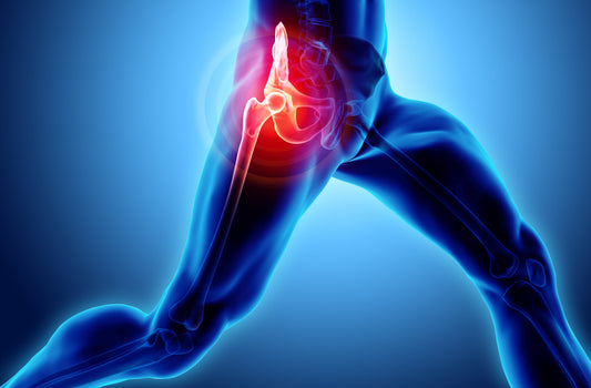 Your Guide to Total Hip Replacement Surgery