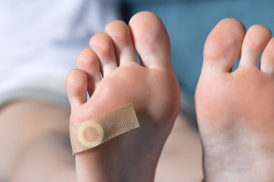 How to treat Plantar Warts naturally