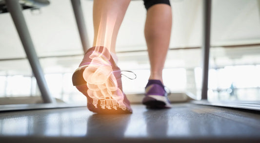Posterior Heel Pain