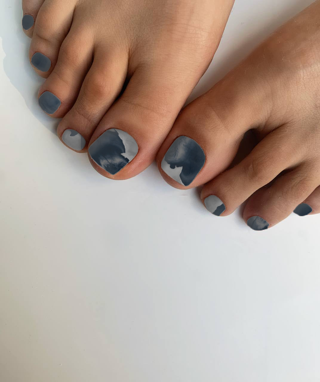 DrLuigi® Orthopedic Slippers for Women - Comfortable green Medical Footwear